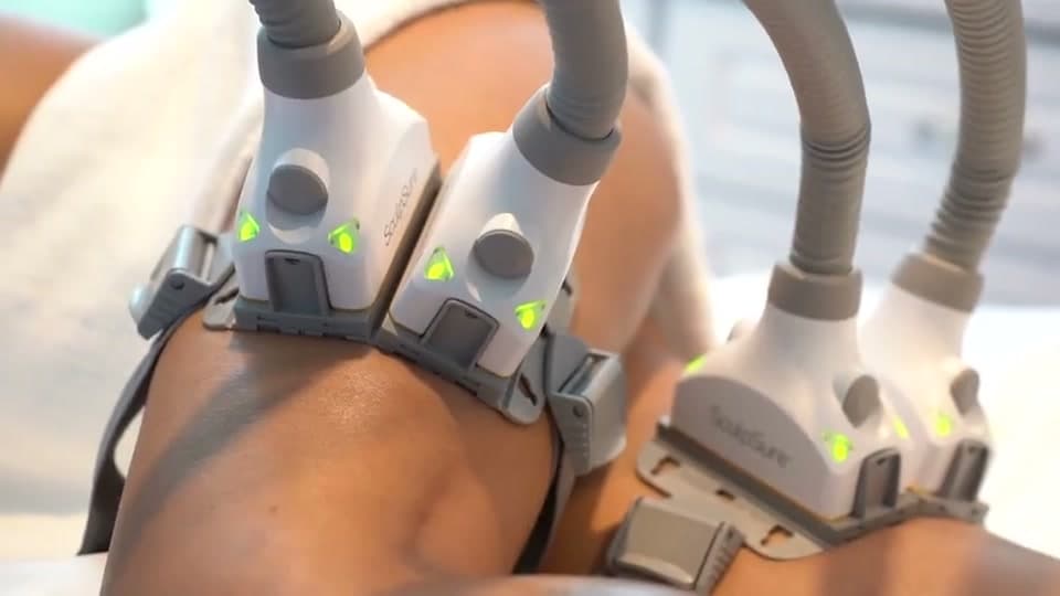 SculpSure® Lipo Láser